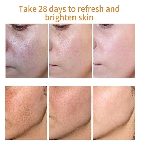 Skin Care Masks & Peels-Luméa